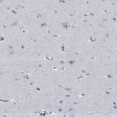 Anti-ITGAE antibody produced in rabbit Prestige Antibodies® Powered by Atlas Antibodies, affinity isolated antibody, buffered aqueous glycerol solution