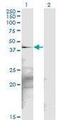 Monoclonal Anti-SGK2 antibody produced in mouse clone 2F6, purified immunoglobulin, buffered aqueous solution