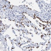 抗-SFTPC 兔抗 Prestige Antibodies® Powered by Atlas Antibodies, affinity isolated antibody, buffered aqueous glycerol solution, Ab1