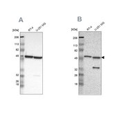 Anti-G6PD antibody produced in rabbit Ab2, Prestige Antibodies® Powered by Atlas Antibodies, affinity isolated antibody, buffered aqueous glycerol solution