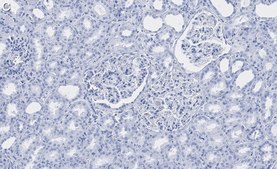 Anti-Spectrin α Antibody, clone 2G17 ZooMAb® Rabbit Monoclonal recombinant, expressed in HEK 293 cells