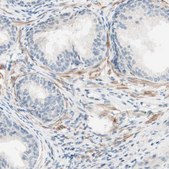 Anti-JPH1 antibody produced in rabbit Ab1, Prestige Antibodies® Powered by Atlas Antibodies, affinity isolated antibody, buffered aqueous glycerol solution