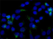 Monoclonal Anti-Cathepsin D antibody produced in mouse clone CTD-19, ascites fluid