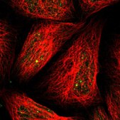 Anti-MUTYH antibody produced in rabbit Prestige Antibodies® Powered by Atlas Antibodies, affinity isolated antibody, buffered aqueous glycerol solution