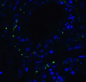 Anti-RIG-1 antibody produced in rabbit purified antibody (DEAE)