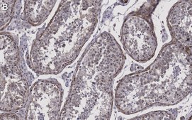 Anti-Pericentrin Antibody, clone 2H11, ZooMAb® Rabbit Monoclonal recombinant, expressed in HEK 293 cells