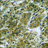 抗 磷酸化-mTOR (pSer 2448 ) 兔抗 affinity isolated antibody