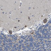 Anti-TMEFF2 antibody produced in rabbit Prestige Antibodies® Powered by Atlas Antibodies, affinity isolated antibody, buffered aqueous glycerol solution