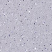 Anti-ABCB4 antibody produced in rabbit Prestige Antibodies® Powered by Atlas Antibodies, affinity isolated antibody, buffered aqueous glycerol solution
