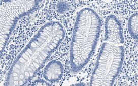 Anti-ARID1A Antibody, clone 1C3 ZooMAb® Rabbit Monoclonal recombinant, expressed in HEK 293 cells