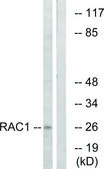Anti-RAC1 antibody produced in rabbit affinity isolated antibody