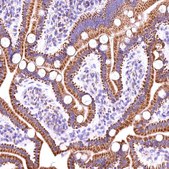 Anti-ACAA2 antibody produced in rabbit Prestige Antibodies® Powered by Atlas Antibodies, affinity isolated antibody, buffered aqueous glycerol solution
