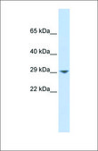 Anti-KCNN2 antibody produced in rabbit affinity isolated antibody