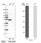 Anti-KRT17 antibody produced in rabbit Ab2, Prestige Antibodies® Powered by Atlas Antibodies, affinity isolated antibody, buffered aqueous glycerol solution