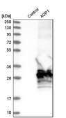 Anti-AQP1 antibody produced in rabbit Prestige Antibodies® Powered by Atlas Antibodies, affinity isolated antibody, buffered aqueous glycerol solution