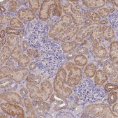 Anti-NPEPPS antibody produced in rabbit Prestige Antibodies® Powered by Atlas Antibodies, affinity isolated antibody, buffered aqueous glycerol solution
