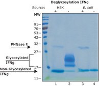 Interferon-γ human IFN-gamma, recombinant, expressed in HEK 293 cells, suitable for cell culture, endotoxin tested