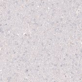 Anti-SLC18A2 antibody produced in mouse Prestige Antibodies® Powered by Atlas Antibodies, clone CL12531, purified by using Protein A, buffered aqueous glycerol solution