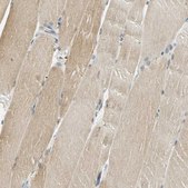 Anti-USP13 antibody produced in rabbit Prestige Antibodies® Powered by Atlas Antibodies, affinity isolated antibody, buffered aqueous glycerol solution