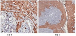 抗钙调节蛋白1抗体 from rabbit, purified by affinity chromatography