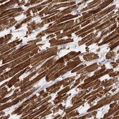 Monoclonal Anti-MYH6 antibody produced in mouse Prestige Antibodies® Powered by Atlas Antibodies, clone CL2148, purified immunoglobulin, buffered aqueous glycerol solution