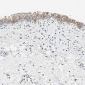 抗-NECTIN4 兔抗 Prestige Antibodies® Powered by Atlas Antibodies, affinity isolated antibody, buffered aqueous glycerol solution