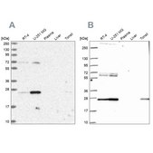 Anti-TFAM antibody produced in rabbit Prestige Antibodies® Powered by Atlas Antibodies, affinity isolated antibody, buffered aqueous glycerol solution