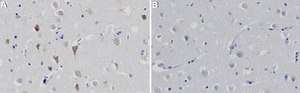 Anti-S1PR2 Antibody, clone 1C18 ZooMAb® Rabbit Monoclonal recombinant, expressed in HEK 293 cells