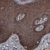 Anti-TRIM7 antibody produced in rabbit Prestige Antibodies® Powered by Atlas Antibodies, affinity isolated antibody, buffered aqueous glycerol solution