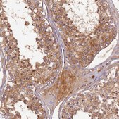 Anti-SOD3 antibody produced in rabbit Prestige Antibodies® Powered by Atlas Antibodies, affinity isolated antibody, buffered aqueous glycerol solution