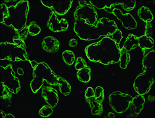 Anti-Cytokeratin, pan antibody, Mouse monoclonal clone PCK-26, purified from hybridoma cell culture