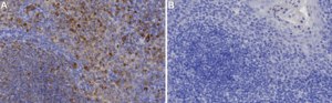 Anti-PTP1B Antibody, clone 2I8 ZooMAb® Rabbit Monoclonal recombinant, expressed in HEK 293 cells