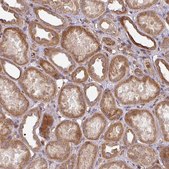 Anti-CASP2 antibody produced in rabbit Prestige Antibodies® Powered by Atlas Antibodies, affinity isolated antibody, buffered aqueous glycerol solution