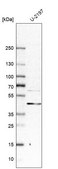 抗-DLC1 兔抗 affinity isolated antibody, buffered aqueous glycerol solution