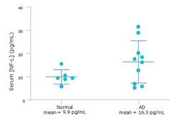 SMC® Human NF-L High Sensitivity Immunoassay Kit
