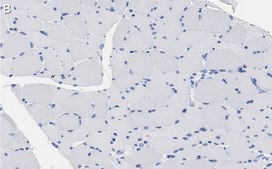 Anti-CACNA2D1 Antibody, clone 1K4 ZooMAb® Rabbit Monoclonal recombinant, expressed in HEK 293 cells
