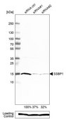 Anti-SSBP1 antibody produced in rabbit Prestige Antibodies® Powered by Atlas Antibodies, affinity isolated antibody, buffered aqueous glycerol solution