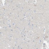 Anti-DUOX1 antibody produced in rabbit Prestige Antibodies® Powered by Atlas Antibodies, affinity isolated antibody, buffered aqueous glycerol solution