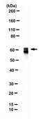 Anti-GAD 65/67 from rabbit, purified by affinity chromatography
