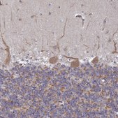 Anti-DVL3 antibody produced in rabbit Prestige Antibodies® Powered by Atlas Antibodies, affinity isolated antibody, buffered aqueous glycerol solution