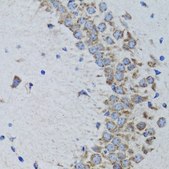 Anti-PTPN1 antibody produced in rabbit