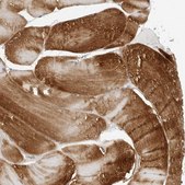 Anti-AMPD1 antibody produced in rabbit Prestige Antibodies® Powered by Atlas Antibodies, affinity isolated antibody, buffered aqueous glycerol solution, ab2