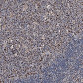 Anti-UQCRC1 antibody produced in rabbit Ab2, Prestige Antibodies® Powered by Atlas Antibodies, affinity isolated antibody, buffered aqueous glycerol solution