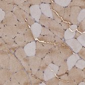 Anti-ENO3 antibody produced in rabbit Prestige Antibodies® Powered by Atlas Antibodies, affinity isolated antibody, buffered aqueous glycerol solution