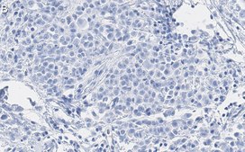 Anti-CDK1/CDC2 Antibody, clone 1J8 ZooMAb® Rabbit Monoclonal recombinant, expressed in HEK 293 cells