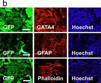 抗神经胶质纤维酸性蛋白抗体，克隆GA5 ascites fluid, clone GA5, Chemicon®
