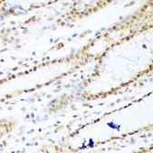 Anti-HDAC1 antibody produced in rabbit