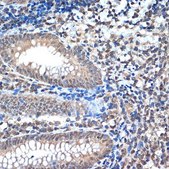 Anti-CoREST/RCOR1 antibody produced in rabbit
