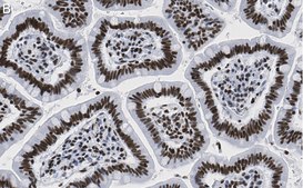 Anti-HDAC1 Antibody, clone 4D21 , ZooMAb® Rabbit Monoclonal recombinant, expressed in HEK 293 cells