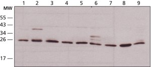 Anti-HMGB1 (HMG1) (C-terminal) antibody produced in rabbit affinity isolated antibody, buffered aqueous solution